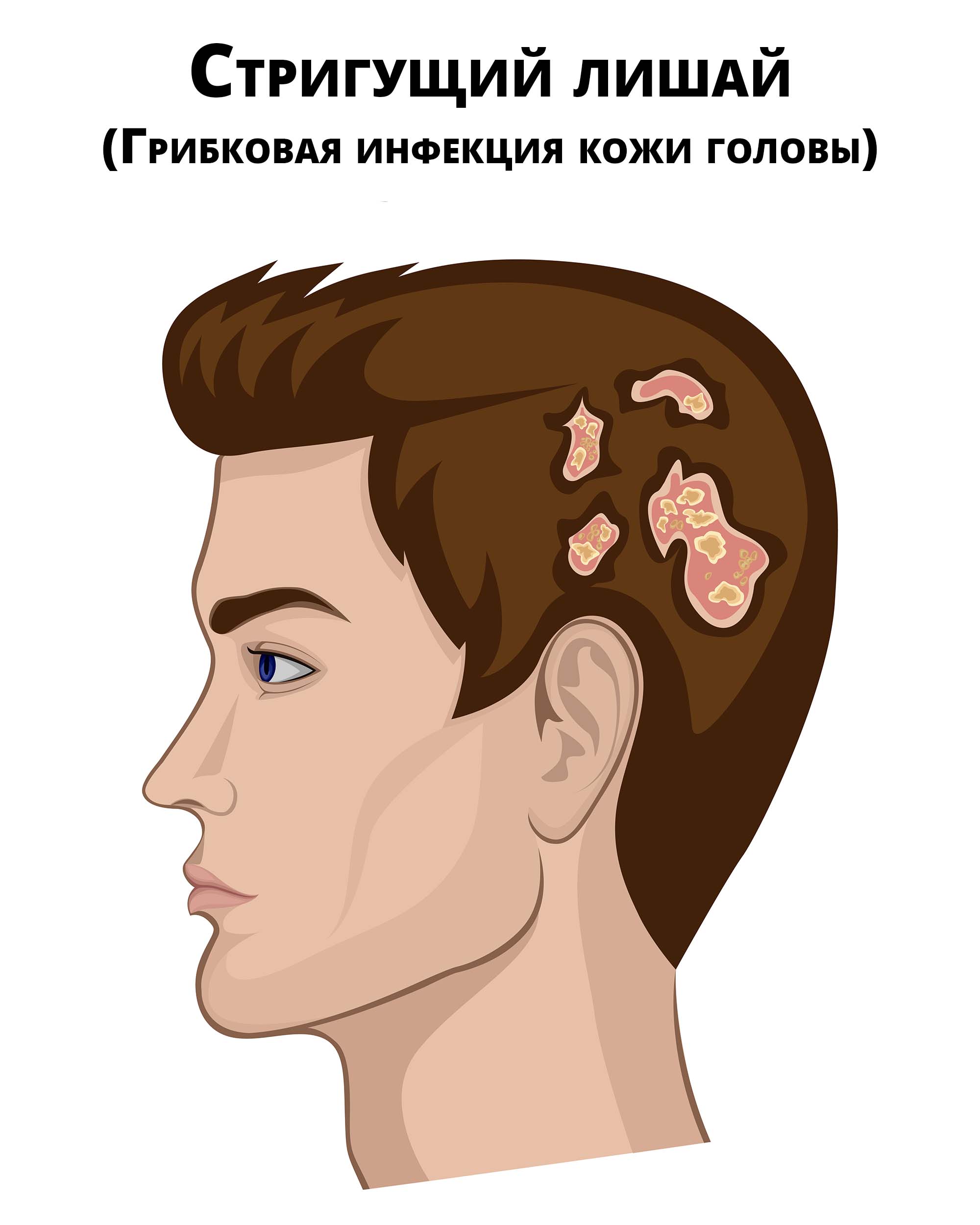 Источники заражения
